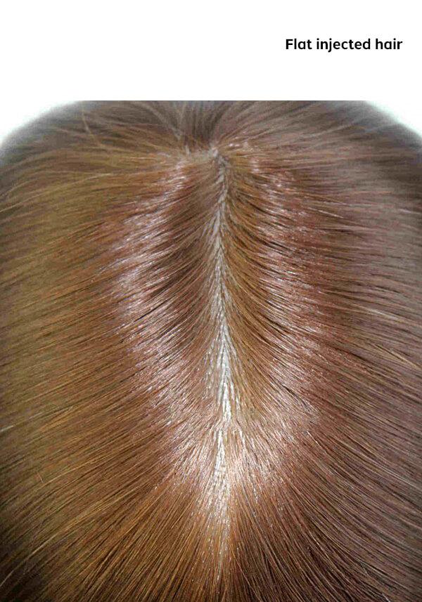 Injected hairpiece